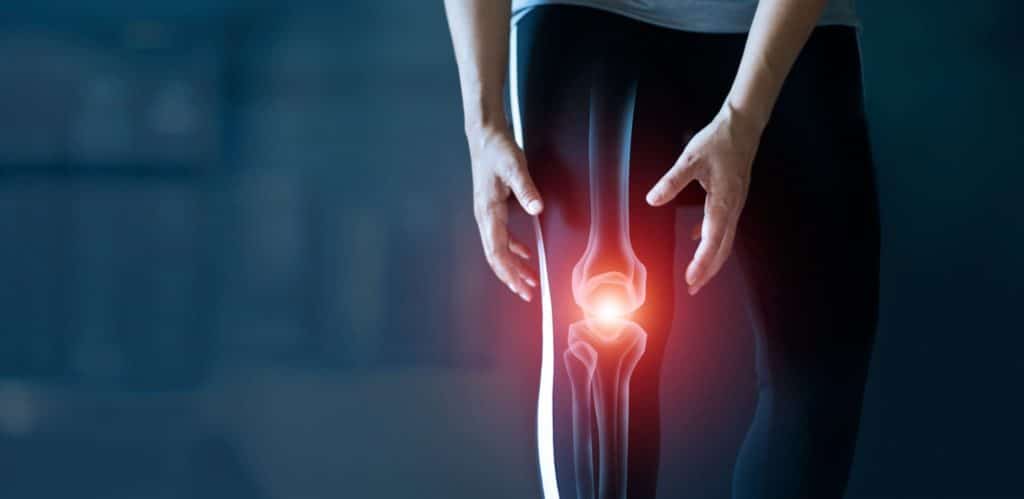 Imagen ilustrativa de una persona padeciendo osteoartritis