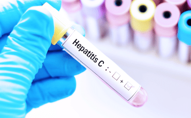hepatitis C