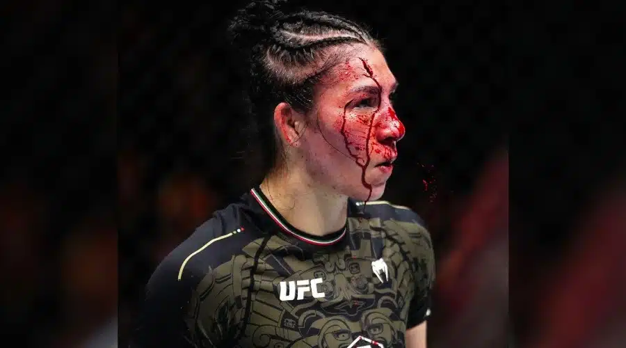 Irene Aldana tiene múltiples cortes en su cara durante su pelea con Norma Dumont en la Noche UFC