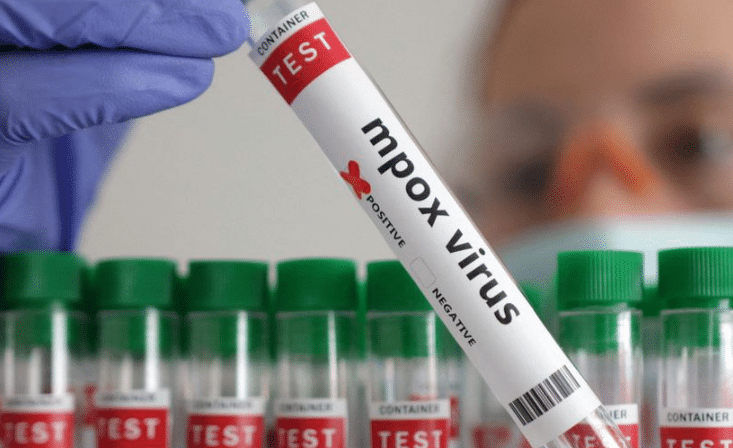 Alemania registra su primer caso de la nueva variante de viruela del mono