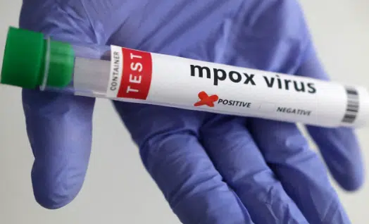 Reino Unido registra primer caso de la nueva y peligrosa variante del virus mpox