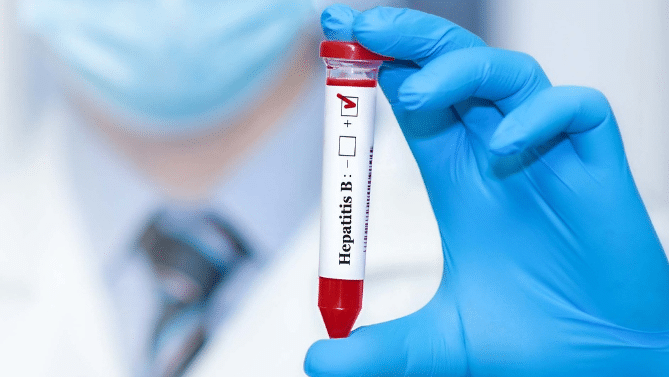 Yucatán alerta por incremento en casos de hepatitis A y B; cifras superan balance del año anterior