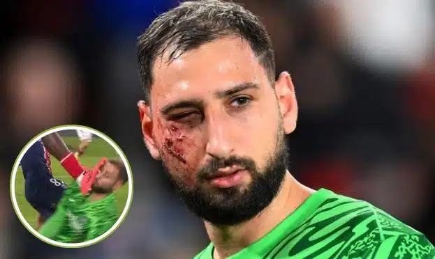 El arquero Donnarumma sufre impactante lesión en el PSG vs Mónaco por la Ligue 1 |