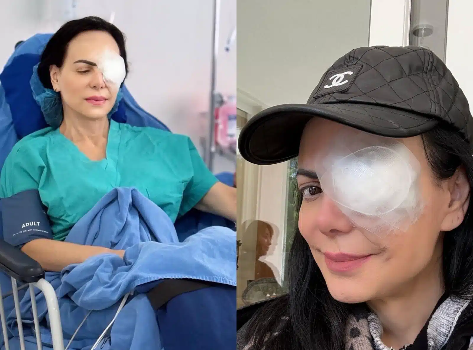 Maribel Guardia inicia el año con un parche en el ojo