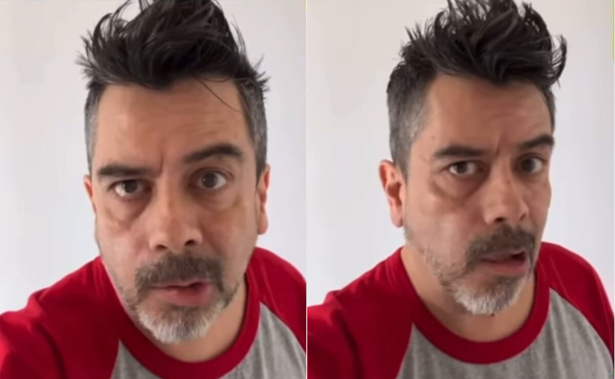 Carlos Espejel reaparece con parálisis facial y asegura que es por estrés