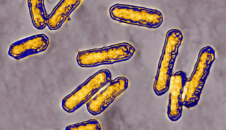Retiran más de 80 productos de comercios en EU por brote de listeria