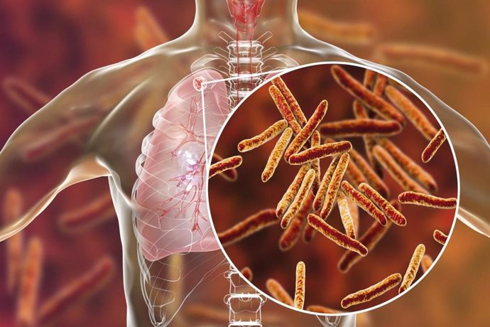 México registra más de 7 mil casos de tuberculosis en 2025; preocupa alza en algunos estados