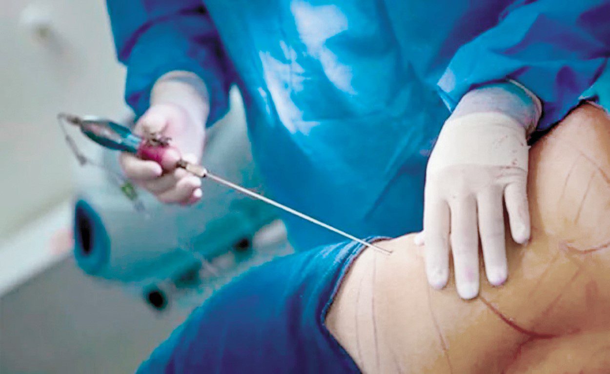 Prácticas de medicina estética