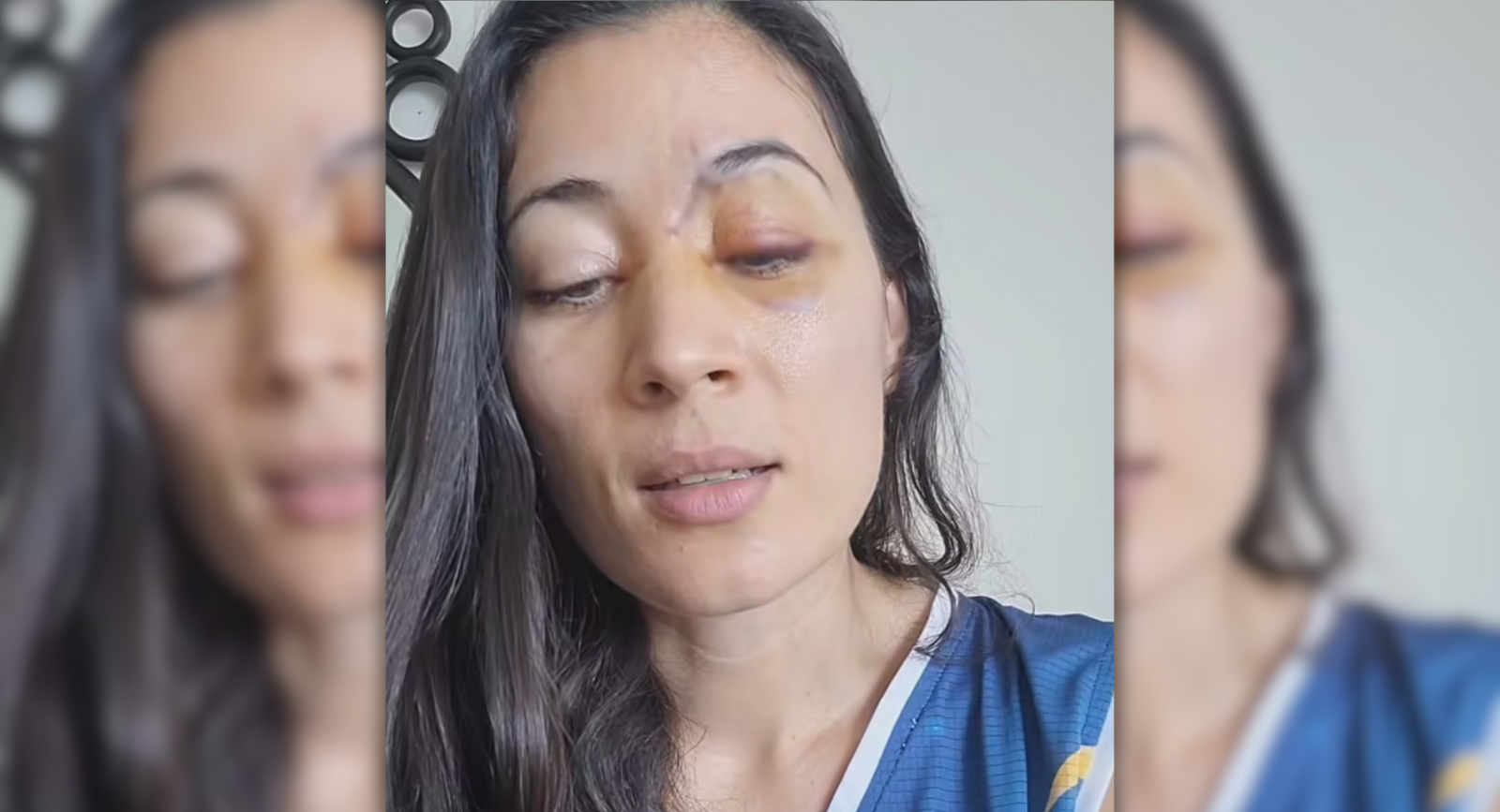 “Por poquito pierdo el ojo”: Patinadora resulta lesionada durante rodada