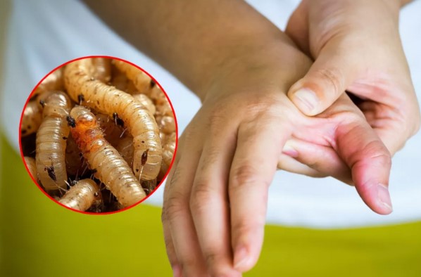 México registra 31 casos de miasis por gusano barrenador en humanos: Salud