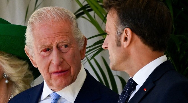Salud del rey Carlos III preocupa de nuevo tras problema en su ojo; Palacio de Buckingham responde