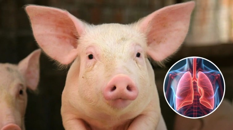 Científicos en China trasplantan pulmón de cerdo modificado a un humano con muerte cerebral