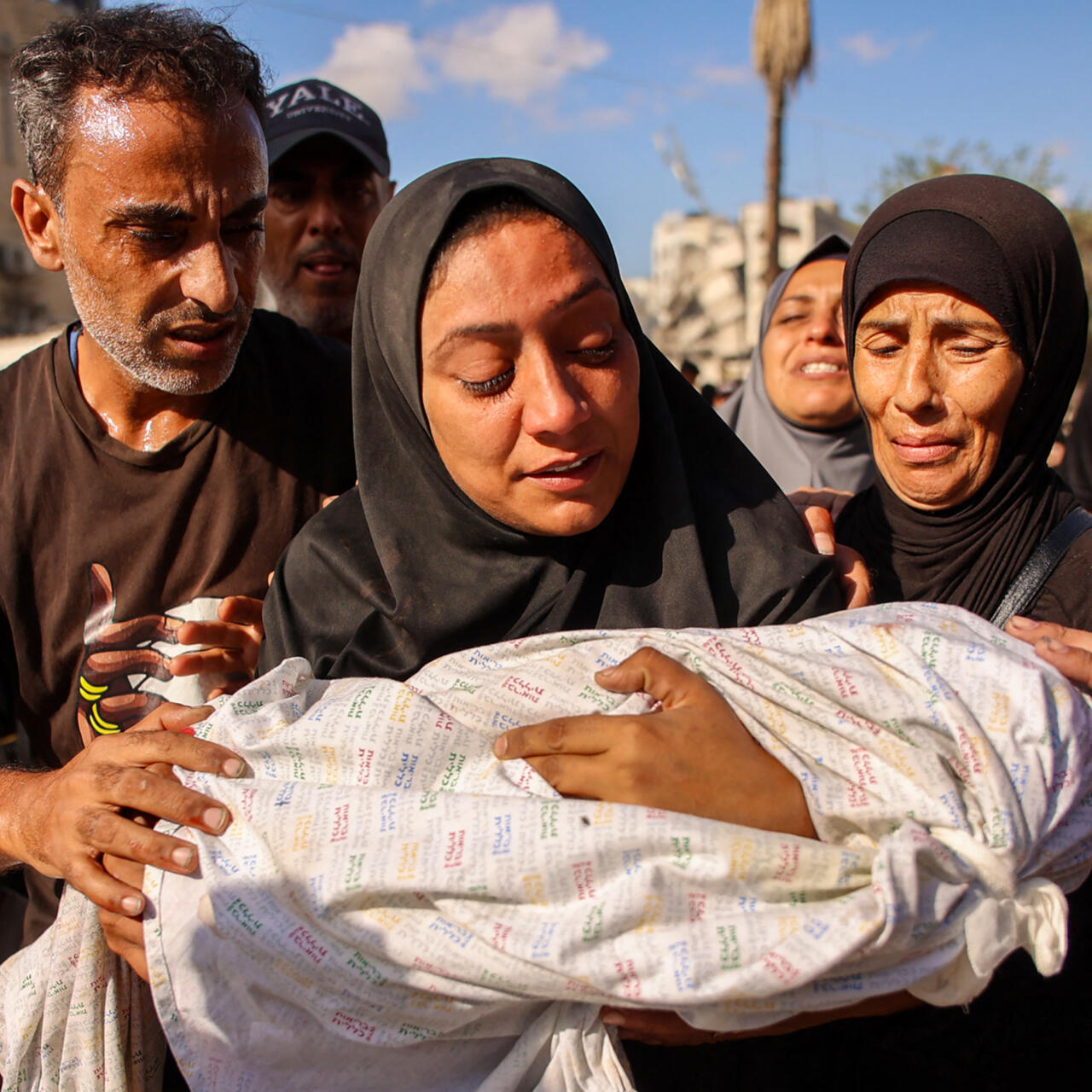 Muere bebé de cinco meses en Gaza por desnutrición en medio de la hambruna