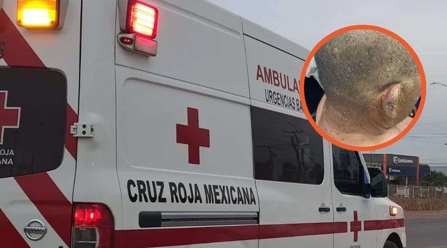 Hombre de 62 años sobrevive a feroz enjambre en El Taballal, Salvador Alvarado