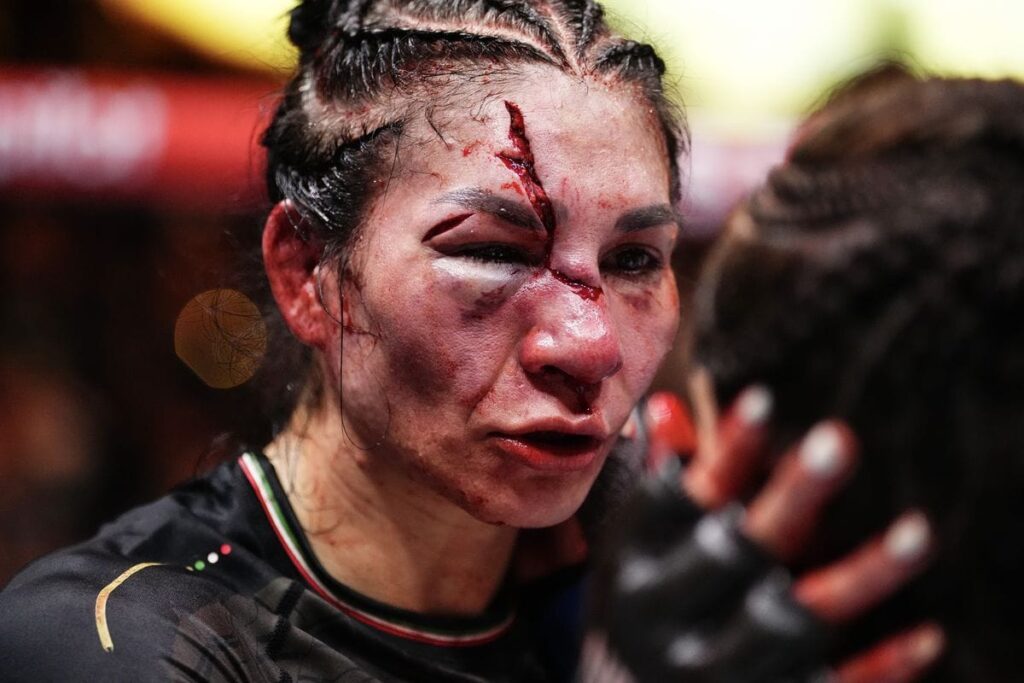 Irene Aldana sufrió un profundo corte facial durante su pelea ante Norma Dumont en Noche UFC 2024