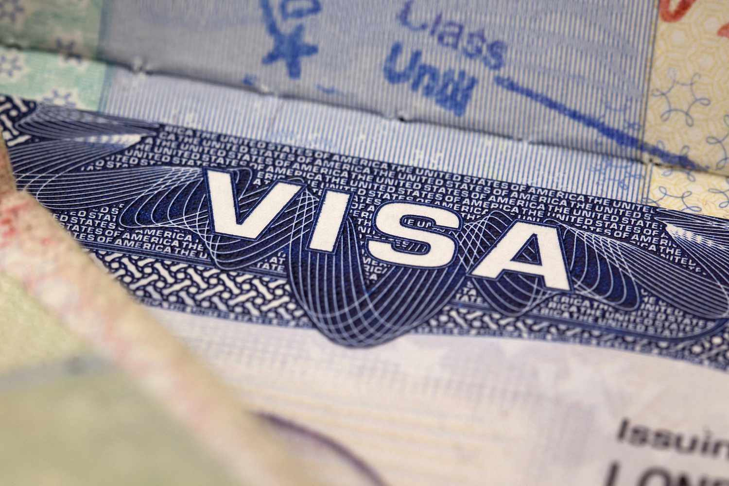 Qué es la visa láser y cómo se tramita