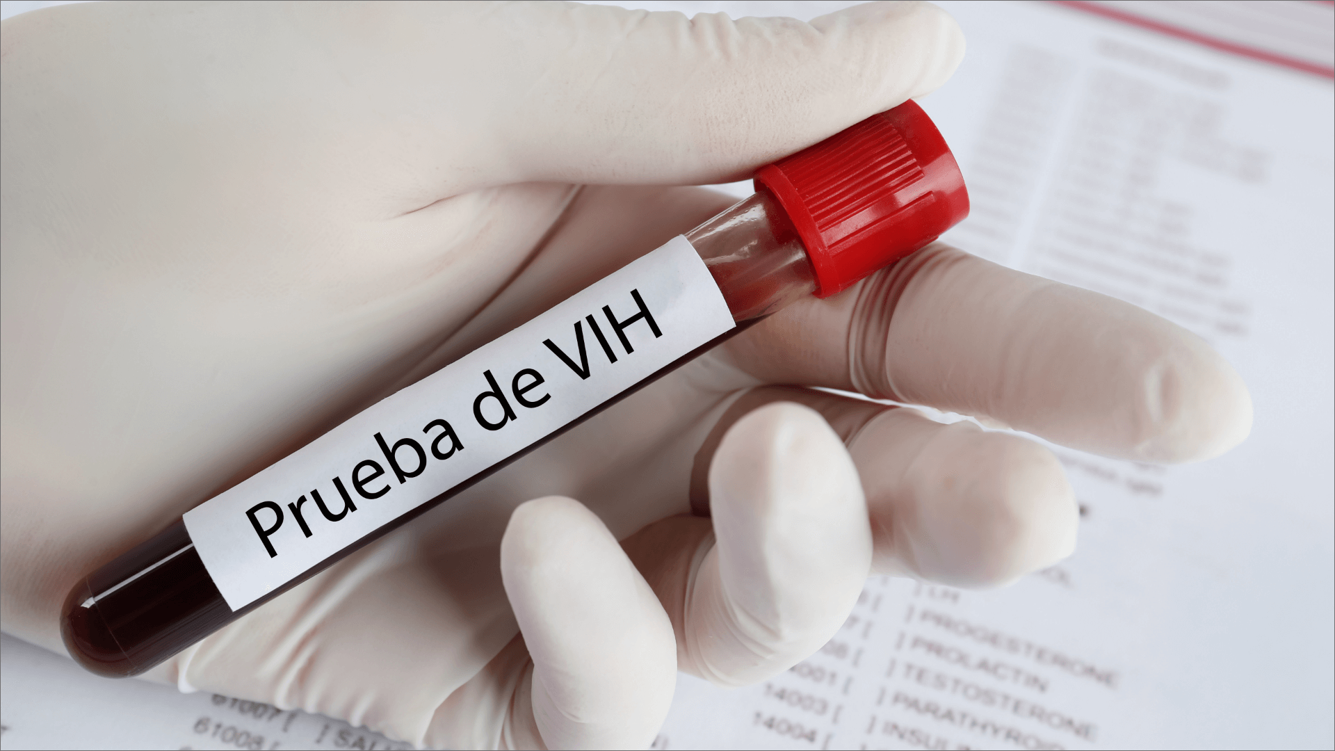 Reportan 52 pacientes activos en la región del Évora