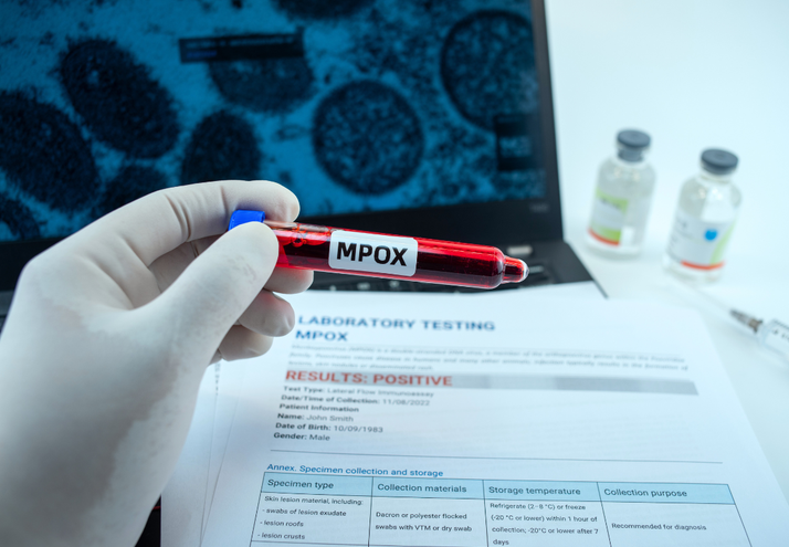 Reino Unido confirma variante recombinante de mpox en viajero procedente de Asia