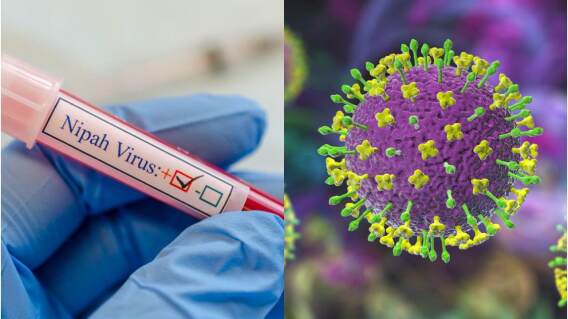 Virus Nipah: ¿Qué es, cuáles son los síntomas y cómo se contagia?