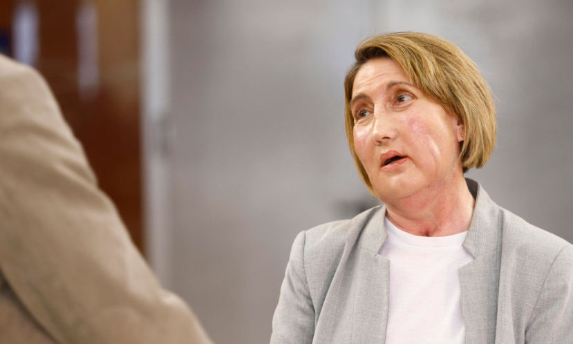 Barcelona protagoniza avance histórico con trasplante facial ligado a eutanasia