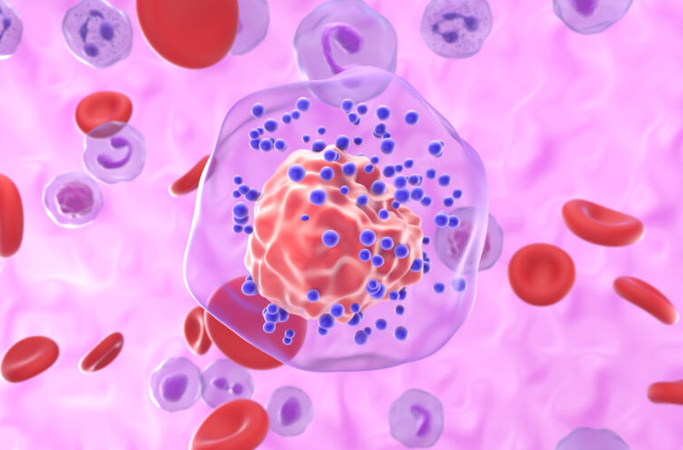 Ensayo europeo abre nueva vía terapéutica contra el cáncer de mama triple negativo