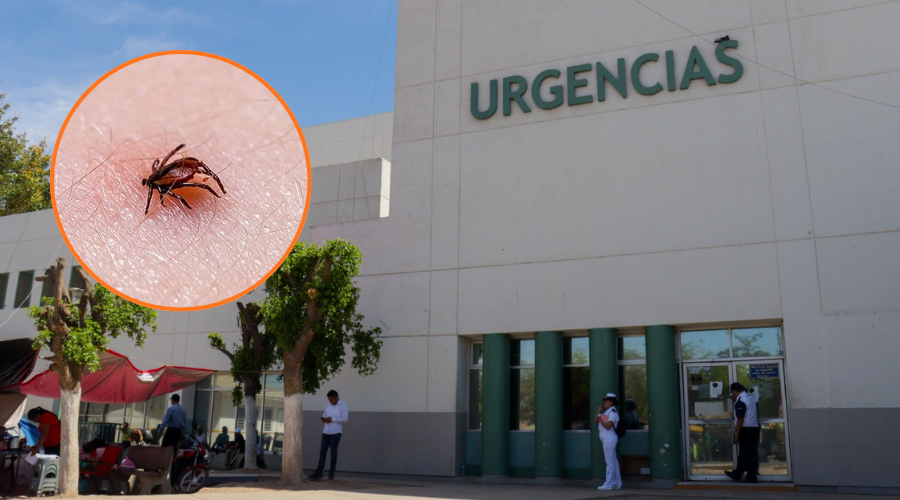 En grande Hospital General de Los Mochis y en circulo garrapata sobre la piel de una persona