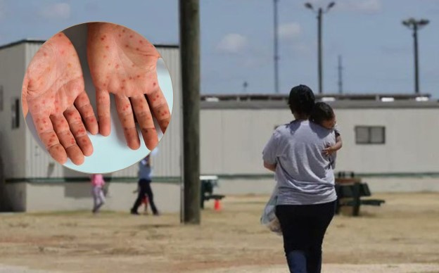 Confinan centro de detención del ICE en Texas tras brote de sarampión
