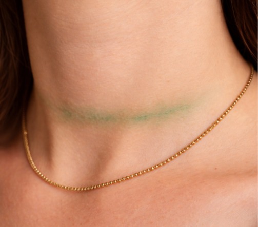 Cuello de una mujer manchado de color verde por usar joyería falsa