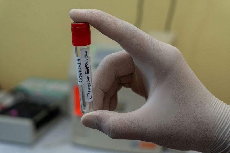 Covid-19: CDC analiza la nueva variante BA.3.2, aparentemente capaz de evadir la inmunidad