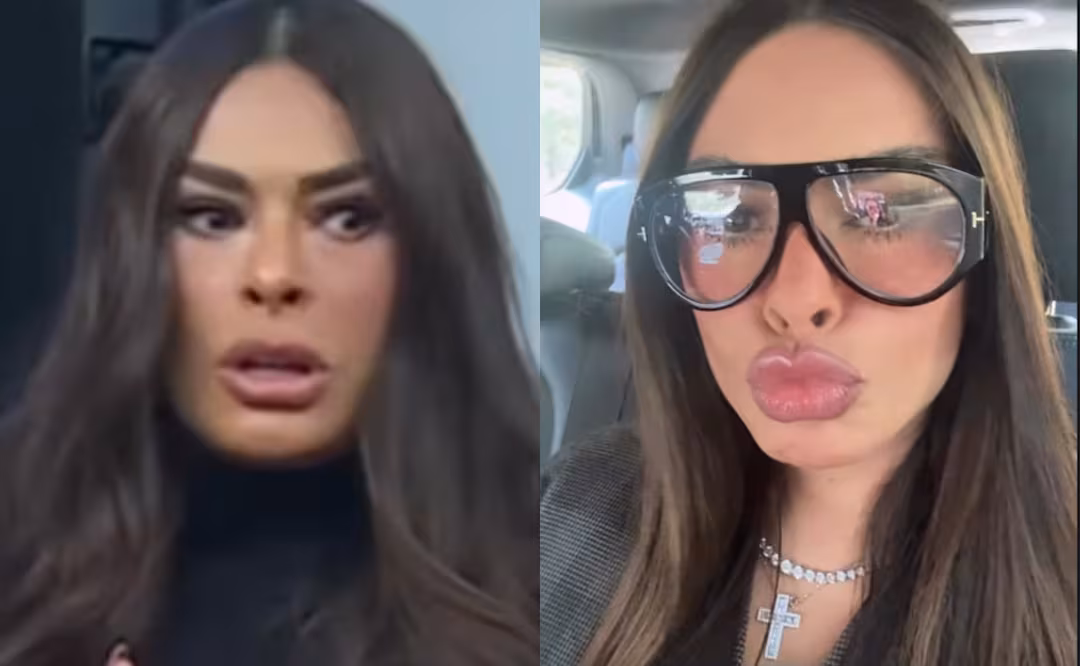 ¿Abuso de procedimientos estéticos? Galilea Montijo enfrenta críticas por cambios en su rostro