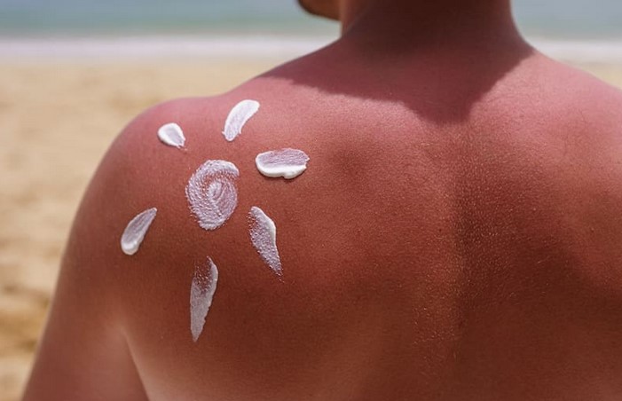 Sol y playa en Semana Santa: ¿Qué hacer en caso de sufrir quemaduras solares?