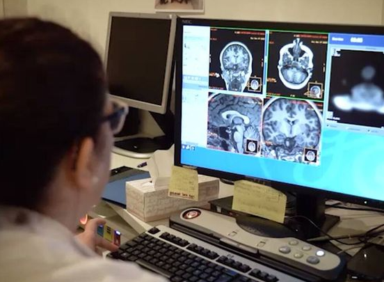¿No recuerdas tus sueños? Podría ser una primera señal de Alzheimer