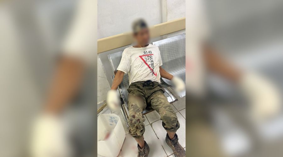 PErsona sentada en un hospital con las manos vendadas