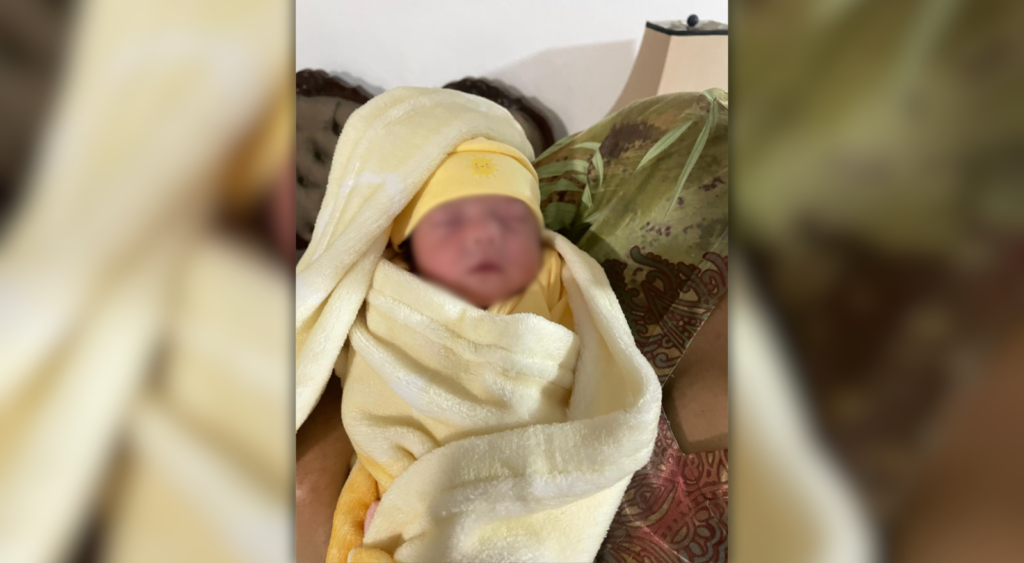La pequeña de 2 meses fue sometida a cirugía por retinopatía del prematuro