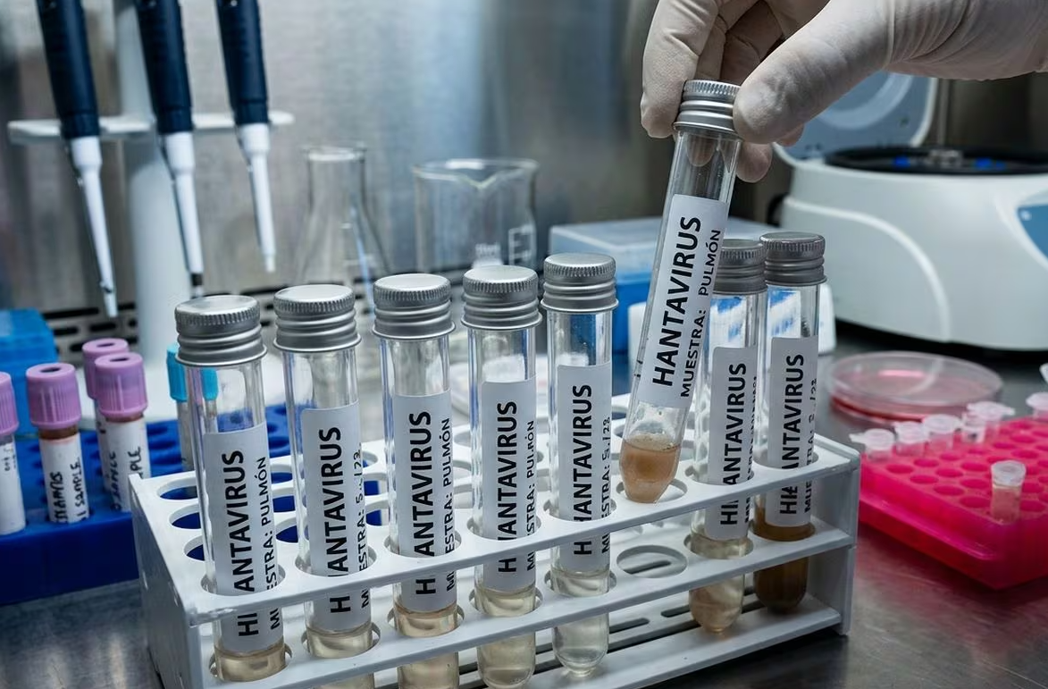 ¿Qué es el hantavirus y cuáles son sus síntomas?