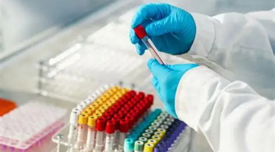 Examen de antidoping