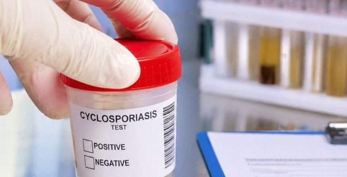 Aseguran que brote de ciclosporiasis está bajo control en Estados Unidos