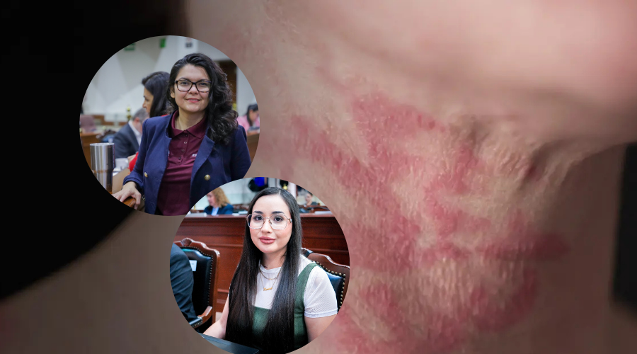 Diputadas de Morena en Sinaloa proponen iniciativa para fortalecer la prevención y atención del lupus